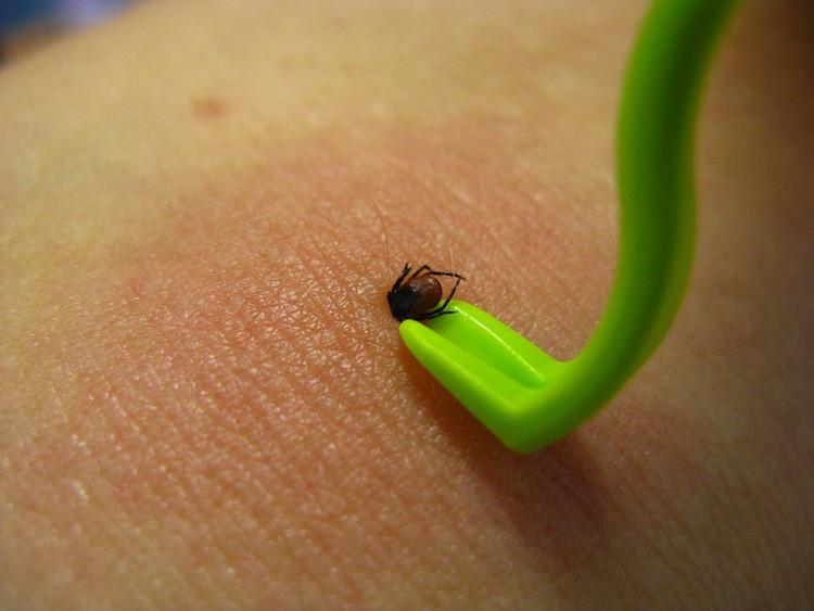 Tick Removal Best Practices (and Mistakes to Avoid)