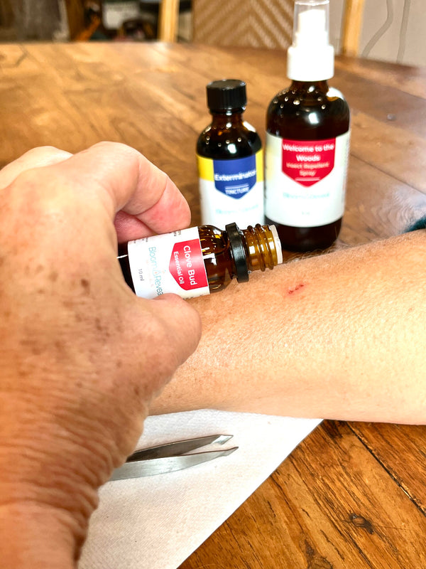 Applying clove oil to tick bite